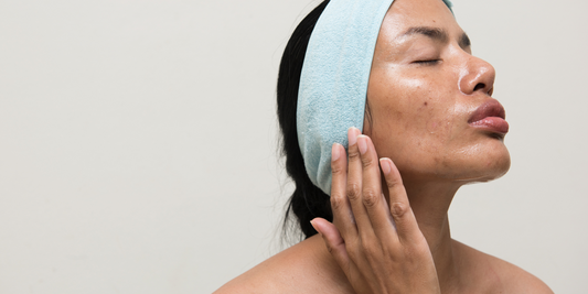 Baobab Oil for Oily Skin: The Natural Solution
